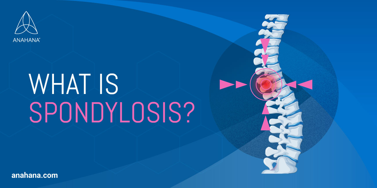 Cervical Spondylosis (Arthritis of the Neck) - OrthoInfo - AAOS